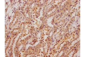 IHC image of ABIN7178861 diluted at 1:200 and staining in paraffin-embedded rat kidney tissue performed on a Leica BondTM system. (Fibronectin 1 抗体  (AA 1175-1451))