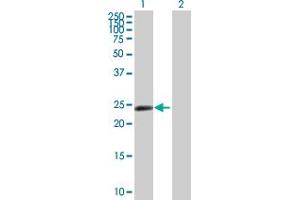 Western Blot analysis of ZNF501 expression in transfected 293T cell line by ZNF501 MaxPab polyclonal antibody. (ZNF501 抗体  (AA 1-262))