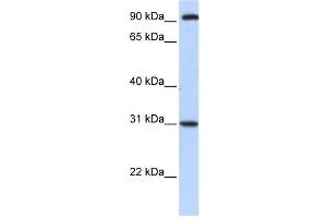 Western Blotting (WB) image for anti-Ankyrin Repeat, Family A (RFXANK-Like), 2 (ANKRA2) antibody (ABIN2459440) (ANKRA2 抗体)