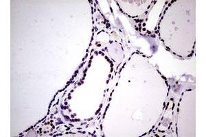 Image no. 2 for anti-Nibrin (NBN) (AA 183-460) antibody (ABIN1491058) (Nibrin 抗体  (AA 183-460))