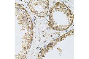 Immunohistochemistry of paraffin-embedded human prostate using POP4 antibody (ABIN6128482, ABIN6145964, ABIN6145966 and ABIN6220640) at dilution of 1:100 (40x lens). (RPP29 抗体  (AA 1-220))
