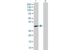 Western Blot analysis of EPHA10 expression in transfected 293T cell line by EPHA10 MaxPab polyclonal antibody. (EPH Receptor A10 抗体  (AA 1-295))