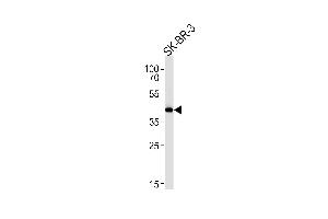 Western blot analysis in SK-BR-3 cell line lysates (35ug/lane). (SOX8 抗体  (AA 225-253))