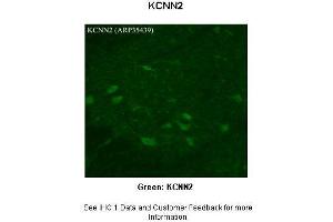 Sample Type :  Rhesus macaque spinal cord  Primary Antibody Dilution :  1:300  Secondary Antibody :  Donkey anti Rabbit 488  Secondary Antibody Dilution :  1:500  Color/Signal Descriptions :  Green: KCNN2  Gene Name :  KCNN2  Submitted by :  Timur Mavlyutov, Ph. (KCNN2 抗体  (Middle Region))
