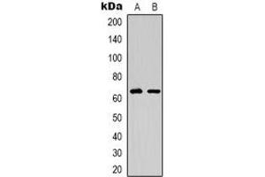 Western blot analysis of EPO Receptor expression in HepG2 (A), COS7 (B) whole cell lysates. (EPOR 抗体)