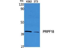 Western Blot (WB) analysis of specific cells using PRPF18 Polyclonal Antibody.