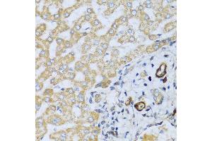 Immunohistochemistry of paraffin-embedded human liver using CSH1 antibody at dilution of 1:100 (40x lens). (CSH1 抗体)