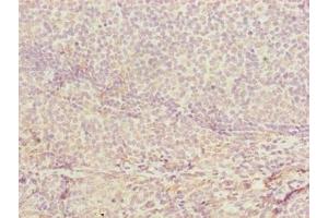 Immunohistochemistry of paraffin-embedded human tonsil tissue using ABIN7149078 at dilution of 1:100 (CDADC1 抗体  (AA 1-99))