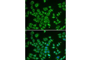 Immunofluorescence analysis of HeLa cell using SMAD1 antibody. (SMAD1 抗体)
