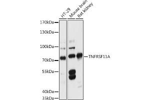 Western blot analysis of extracts of various cell lines, using TNFRSF11A antibody (ABIN6127588, ABIN6149309, ABIN6149311 and ABIN6216817) at 1:3000 dilution. (TNFRSF11A 抗体  (AA 466-616))