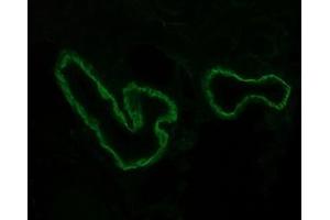 Image no. 2 for anti-Integrin, alpha 3 (ITGA3) (Cytoplasmic Domain) antibody (ABIN959430) (ITGA3 抗体  (Cytoplasmic Domain))