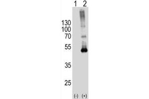 Western blot analysis of SPHK1 antibody and 293T cell lysate either nontransfected (Lane 1) or transiently transfected (2) with the SPHK1 gene. (SPHK1 抗体  (AA 1-30))
