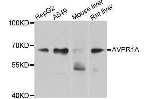 Western blot analysis of extracts of various cells, using AVPR1A antibody. (AVPR1A 抗体)