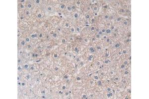 Used in DAB staining on fromalin fixed paraffin- embedded Kidney tissue (PTGFRN 抗体  (AA 406-662))
