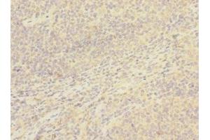 Immunohistochemistry of paraffin-embedded human tonsil tissue using ABIN7171407 at dilution of 1:100 (CD8B 抗体  (AA 22-170))