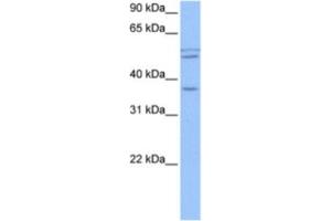 Western Blotting (WB) image for anti-Coiled-Coil Domain Containing 78 (CCDC78) antibody (ABIN2463547) (CCDC78 抗体)