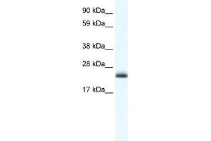 WB Suggested Anti-Tppp Antibody Titration:  1. (Tppp 抗体  (C-Term))