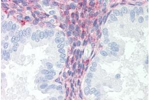Human Uterus (formalin-fixed, paraffin-embedded) stained with LRP1 antibody ABIN351532 at 10 ug/ml followed by biotinylated anti-mouse IgG secondary antibody ABIN481714, alkaline phosphatase-streptavidin and chromogen. (LRP1 抗体)