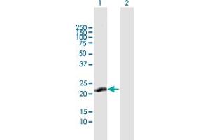 Western Blot analysis of C13orf1 expression in transfected 293T cell line by C13orf1 MaxPab polyclonal antibody. (CLLD6 抗体  (AA 1-196))