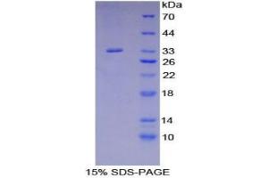 SDS-PAGE analysis of Human SHB Protein. (Src Homology 2 Domain Containing Adapter Protein B 蛋白)