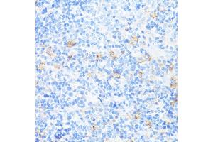 Immunohistochemistry of paraffin-embedded rat spleen using CD11a/LFA-1A/ITGAL antibody (ABIN3015541, ABIN3015542, ABIN3015543, ABIN1680526 and ABIN6218728) at dilution of 1:100 (40x lens).
