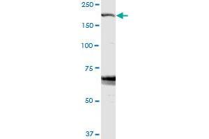 ZFYVE9 MaxPab rabbit polyclonal antibody. (ZFYVE9 抗体  (AA 1-762))