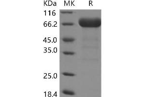 Western Blotting (WB) image for EPH Receptor A3 (EPHA3) (Active) protein (His tag) (ABIN7195523)