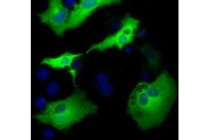 Anti-AK5 mouse monoclonal antibody (ABIN2452722) immunofluorescent staining of COS7 cells transiently transfected by pCMV6-ENTRY AK5 (RC222241). (Adenylate Kinase 5 抗体)