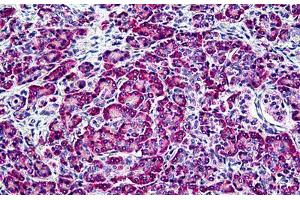Human Pancreas: Formalin-Fixed, Paraffin-Embedded (FFPE)