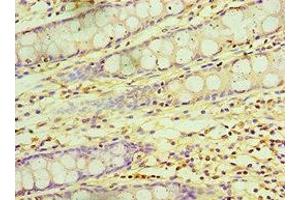 Immunohistochemistry of paraffin-embedded human colon tissue using ABIN7145839 at dilution of 1:100 (KCTD15 抗体  (AA 1-234))
