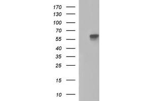 Western Blotting (WB) image for anti-Placental Alkaline Phosphatase (ALPP) antibody (ABIN2715939) (PLAP 抗体)