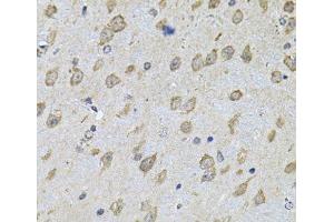 Immunohistochemistry of paraffin-embedded Mouse brain using NFU1 Polyclonal Antibody at dilution of 1:100 (40x lens). (NFU1 抗体)