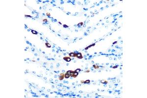 anti-Piwi-Like 1 (PIWIL1) antibody