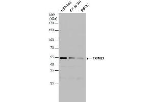 WB Image TRIM27 antibody detects TRIM27 protein by western blot analysis. (TRIM27 抗体)