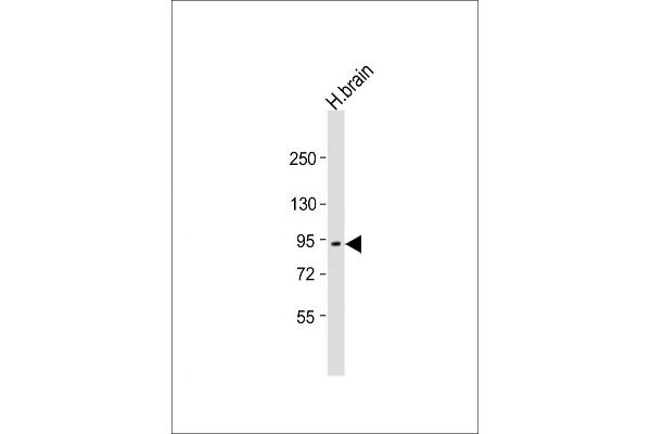 Neurotrypsin 抗体  (AA 145-180)