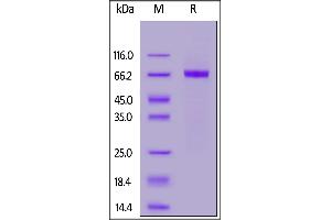 SDS-PAGE (SDS) image for Receptor tyrosine-protein kinase erbB-2 (ErbB2/Her2) (AA 23-510) (Active) protein (His tag) (ABIN7013682)