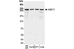 Western Blotting (WB) image for anti-hSET1 (AA 1200-1250) antibody (ABIN7449888) (hSET1 (AA 1200-1250) 抗体)