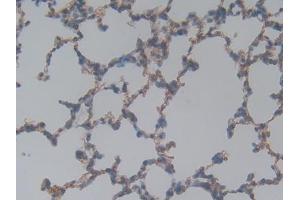 DAB staining on IHC-P; Samples: Rat Lung Tissue (Laminin gamma 1 抗体  (AA 1283-1551))