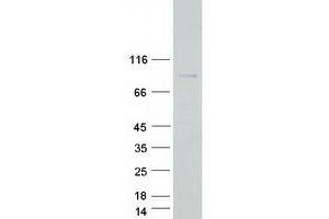 CCDC120 Protein (Transcript Variant 1) (Myc-DYKDDDDK Tag)