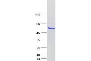 Western Blotting (WB) image for Inositol Hexakisphosphate Kinase 3 (IP6K3) (Transcript Variant 1) protein (Myc-DYKDDDDK Tag) (ABIN2723502)