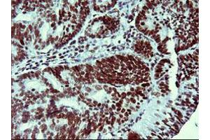 Image no. 1 for anti-Tumor Protein P73 (TP73) (AA 167-409) antibody (ABIN1491005) (Tumor Protein p73 抗体  (AA 167-409))