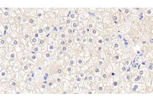 Detection of GSTM1 in Human Liver Tissue using Polyclonal Antibody to Glutathione S Transferase Mu 1 (GSTM1) (GSTM1 抗体  (AA 1-218))