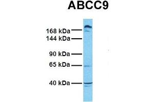 Host:  Rabbit  Target Name:  ABCC9  Sample Tissue:  Human PANC1  Antibody Dilution:  1. (ABCC9 抗体  (Middle Region))