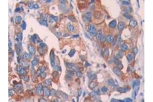 Used in DAB staining on fromalin fixed paraffin- embedded kidney tissue (LOXL4 抗体  (AA 399-552))