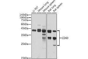 Western blot analysis of extracts of various cell lines, using CD69 antibody (ABIN3022774, ABIN3022775, ABIN3022776 and ABIN6219223) at 1:1000 dilution. (CD69 抗体  (AA 62-199))