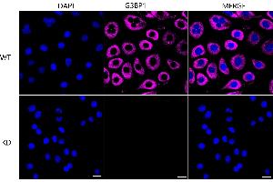 Immunocytochemical staining of HeLa cells using G3BP1 antibody (ABIN7798815), 1:1,000), Top panel: wild-type (WT), Bottom panal: G3BP1 shRNA knockdown (KD). (Recombinant G3BP1 抗体)