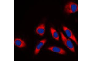 Immunofluorescent analysis of HSP60 staining in NIH3T3 cells. (HSPD1 抗体  (C-Term))