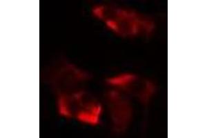 ABIN6277116 staining  HepG2 cells by IF/ICC. (XRCC3 抗体  (N-Term))