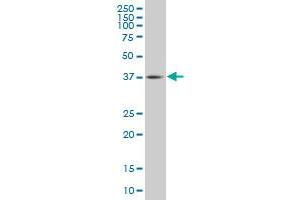 TFDP3 monoclonal antibody (M02), clone 3F11 Western Blot analysis of TFDP3 expression in IMR-32 . (TFDP3 抗体  (AA 1-100))