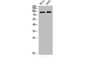 Western Blot analysis of HELA 293T cells using Phospho-GR (S226) Polyclonal Antibody (Glucocorticoid Receptor 抗体  (pSer226))